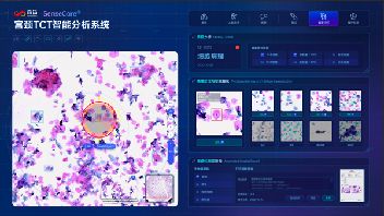 AI辅助宫颈癌早筛